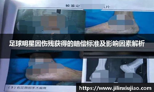足球明星因伤残获得的赔偿标准及影响因素解析